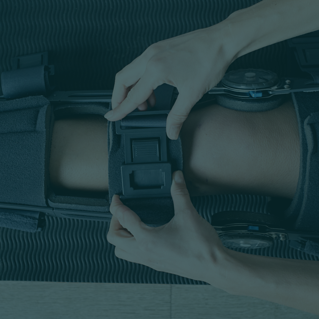 Knee Bracing: Is It Right For You?