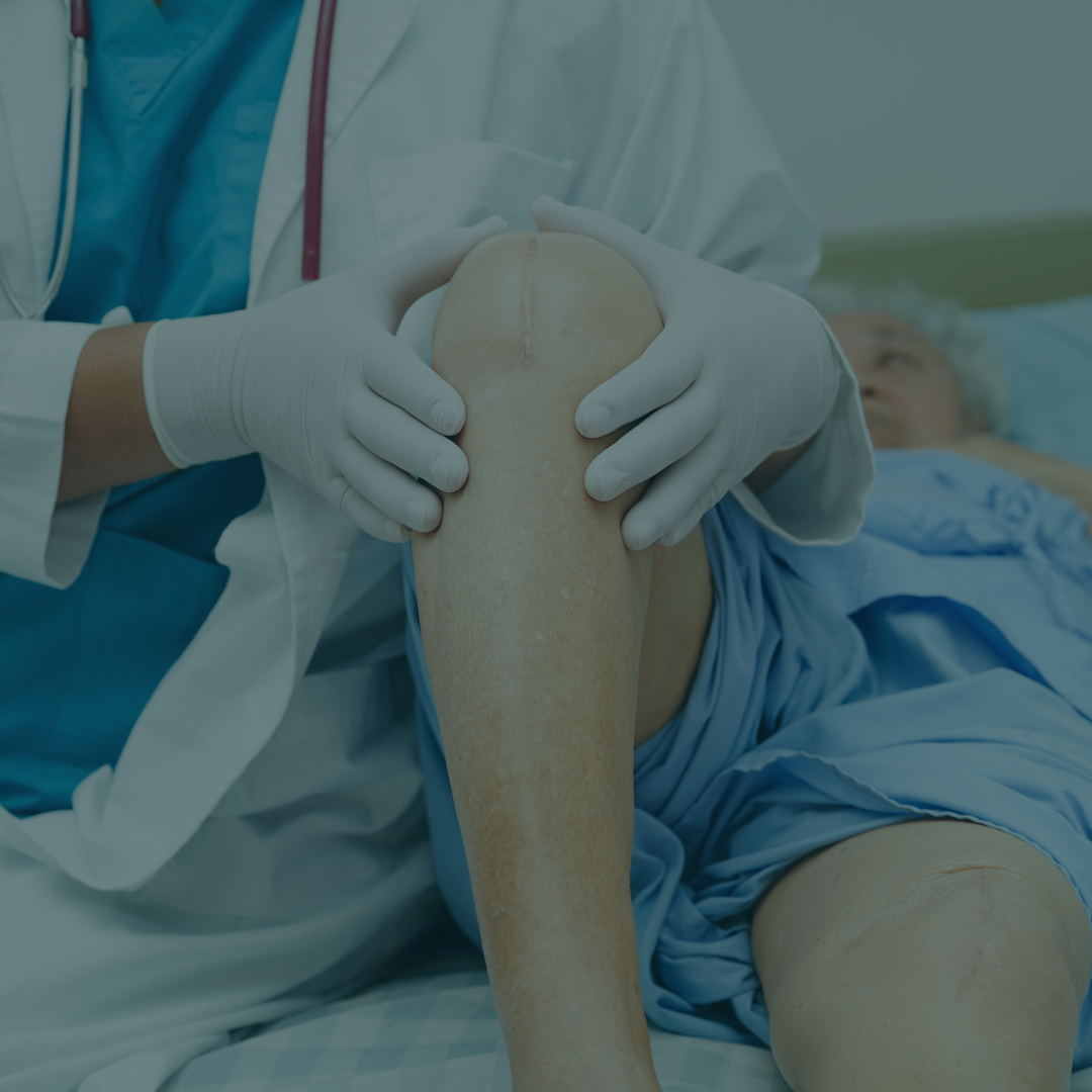 Top 5 Alternatives To Knee Surgery In Chesterfield, VA