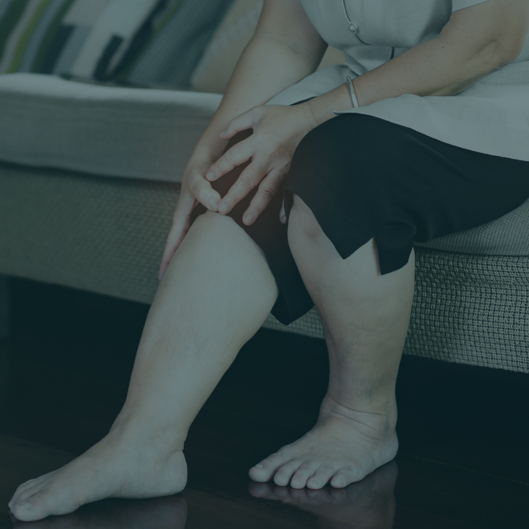 Osteoarthritis In Milwaukee: Non-Surgical Joint Pain Solutions That Work